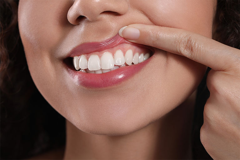 how-to-care-for-your-gums-7-tips-for-national-gum-care-month-strip1